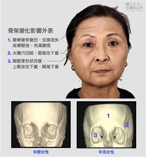 夫妻宮凹陷化解|夫妻宮有什麼特點？天府天相坐守，婚姻美滿恩愛 